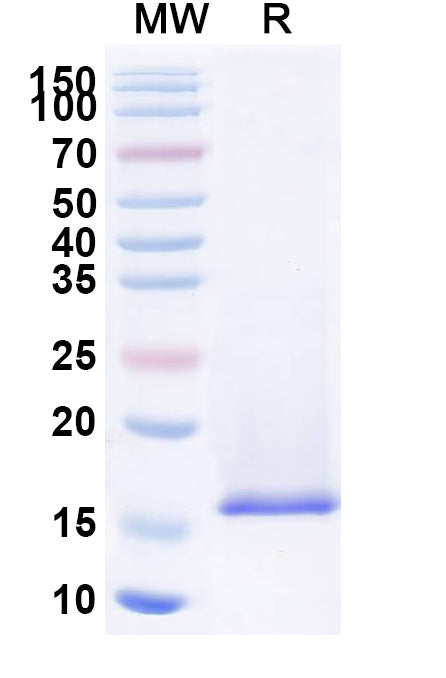 SDS-PAGE for Anti-Clostridium botulinum botA/BOTOX Nanobody (SAA0929)