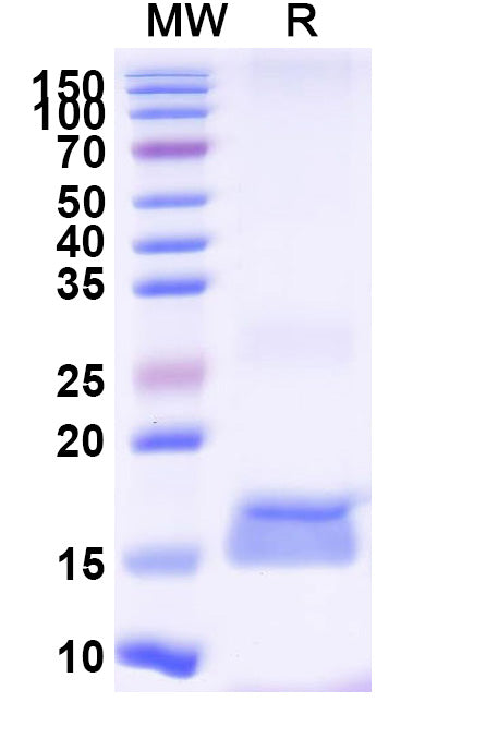 SDS-PAGE for Anti-Clostridium botulinum botA/BOTOX Nanobody (SAA0930)