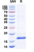 SDS-PAGE for Anti-Clostridium botulinum botA/BOTOX Nanobody (SAA0931)