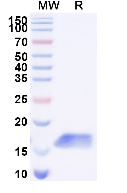 SDS-PAGE for Anti-Clostridium botulinum botA/BOTOX Nanobody (SAA0936)