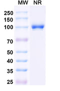 SDS-PAGE for Anti-Clostridium botulinum botA/BOTOX Antibody (Aa1).