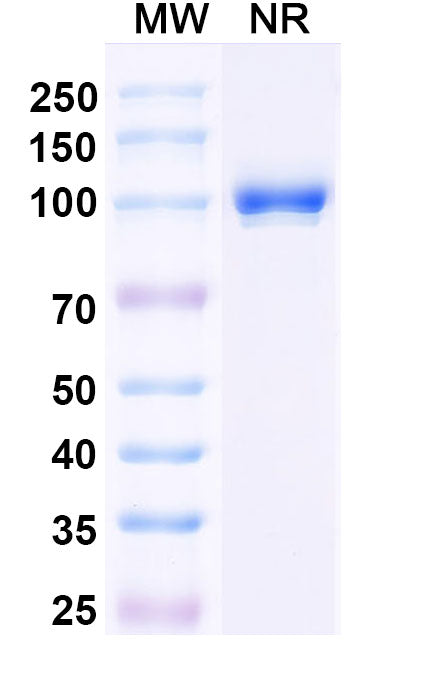 SDS-PAGE for Anti-Clostridium botulinum botA/BOTOX Antibody (Aa1).