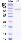 SDS-PAGE for Anti-Clostridium botulinum botA/BoNT Antibody (VH15).