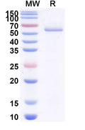 SDS-PAGE for Anti-Clostridium botulinum botA/BoNT Antibody (VHH17).
