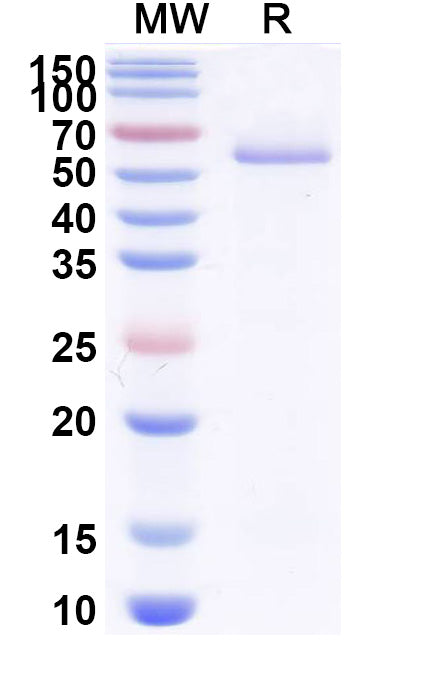 SDS-PAGE for Anti-Clostridium botulinum botA/BoNT Antibody (VHH17).