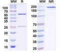SDS-PAGE for Anti-Clostridium botulinum botA/BoNT Antibody (1F3).