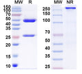 SDS-PAGE for Anti-Clostridium botulinum botA/BoNT Antibody (F1-40)