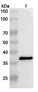 Western blot analysis was performed using anti-beta-channel forming cytolysin CPB polyclonal antibody at 1ug/mL on various samples.
Lane 1: recombinant Clostridium perfringens cpb/Beta-toxin (Catalog No: JN890012)