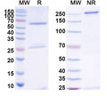 SDS-PAGE for Anti-Bacillus anthracis PA/pagA/PA-83 Antibody (M18)