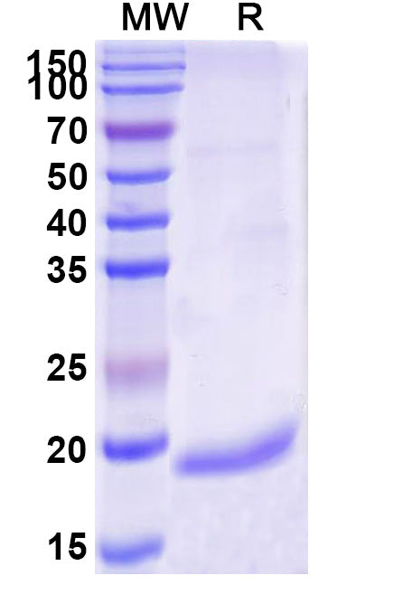 SDS-PAGE for Anti-Bacillus anthracis PAD4 Nanobody (VHH10)