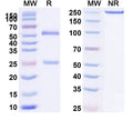 SDS-PAGE for Anti-Toxoplasma gondii SAG1/Major surface antigen p30 Antibody (SAA2154)