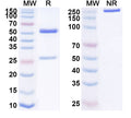 SDS-PAGE for Anti-Helicobacter pylori vacA Antibody (N04-A5)