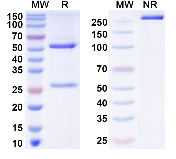 SDS-PAGE for Anti-Helicobacter pylori vacA Antibody (N03-F10)