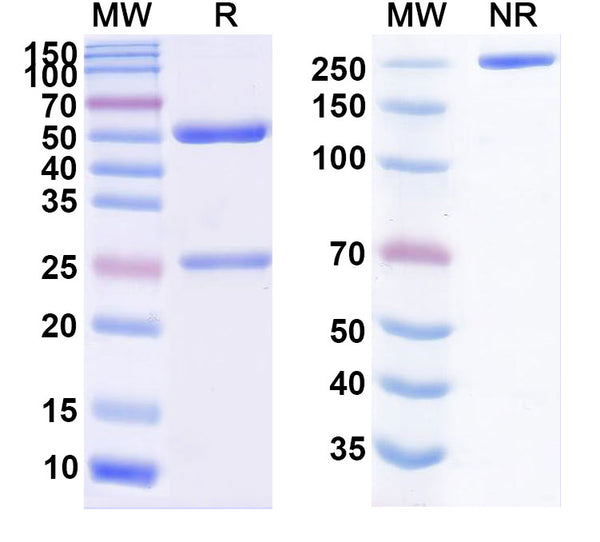 SDS-PAGE for Anti-Helicobacter pylori vacA Antibody (N01-F4)