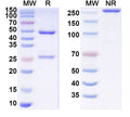 SDS-PAGE for Anti-Plasmodium falciparum MTIP Antibody (SAA1445)