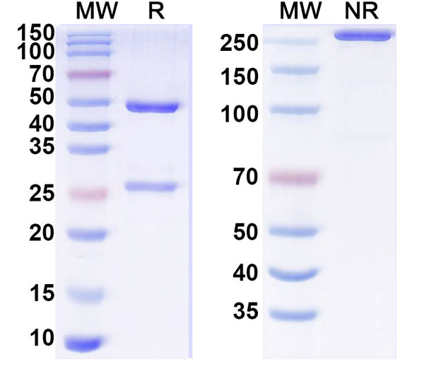 SDS-PAGE for Anti-Plasmodium falciparum MTIP Antibody (SAA1445)