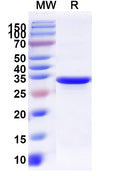 Recombinant Salmonella typhimurium murE Protein, N-His