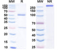 SDS-PAGE for Anti-Eimeria tenella Microneme protein Monoclonal Antibody (1A149)