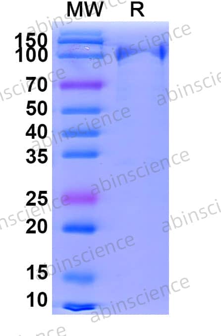 SDS-PAGE for EndoS