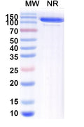SDS-PAGE for Anti-Bacillus cereus blm/Metallo-beta-lactamase type 2 Antibody (SAA1991).