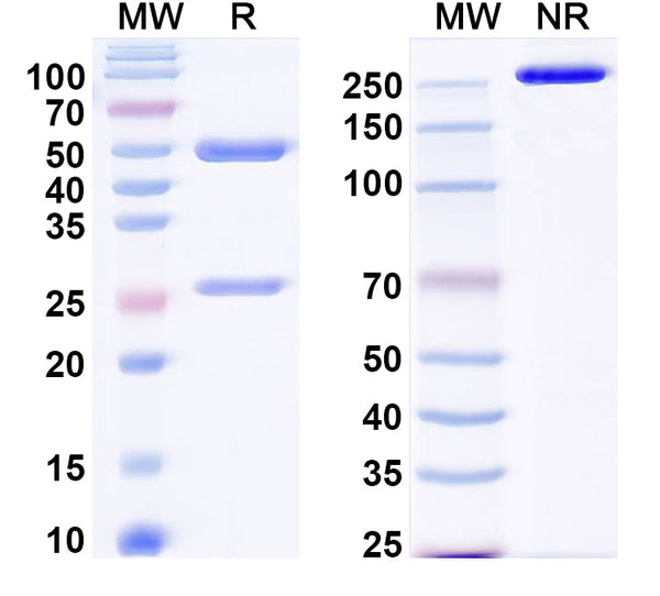 SDS-PAGE for Anti-Plasmodium falciparum MSA2/MSP2 Antibody (6D8)