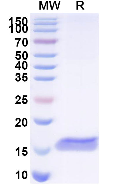 SDS-PAGE for Anti-Clostridium botulinum BoNT/B Nanobody (SAA0977)