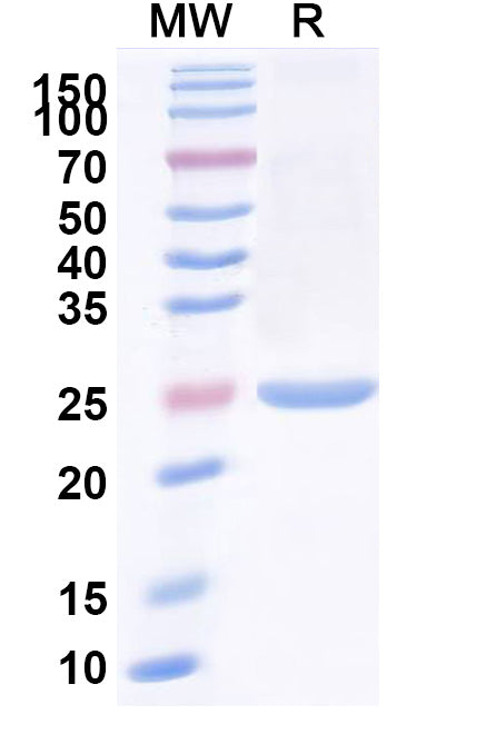 SDS-PAGE for Anti-Clostridium botulinum BoNT/B Nanobody (SAA0939)