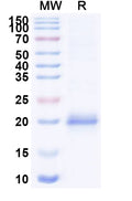 SDS-PAGE for Anti-Clostridium botulinum BoNT/B Nanobody (SAA0940)