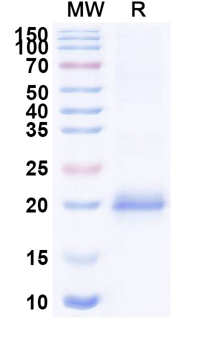 SDS-PAGE for Anti-Clostridium botulinum BoNT/B Nanobody (SAA0940)