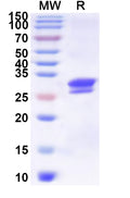 Recombinant Helicobacter pylori ureA/Urease subunit alpha Protein, N-His