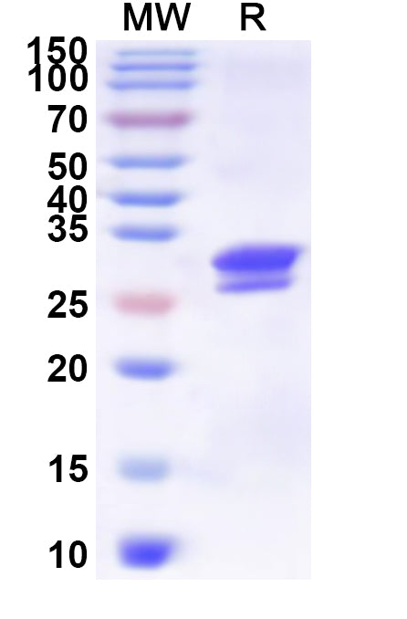 Recombinant Helicobacter pylori ureA/Urease subunit alpha Protein, N-His