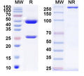 SDS-PAGE for Anti-Helicobacter pylori ureA/Urease subunit alpha Antibody (HpU-18)