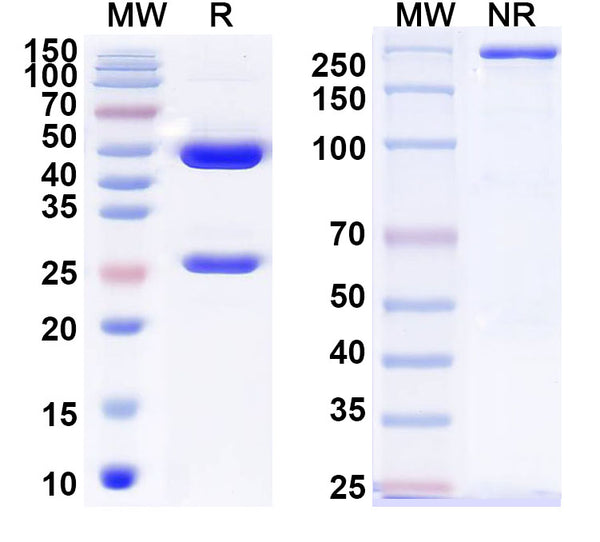 SDS-PAGE for Anti-Helicobacter pylori ureA/Urease subunit alpha Antibody (HpU-18)