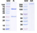 SDS-PAGE for Anti-Helicobacter pylori ureA/Urease subunit alpha Antibody (HpU-2)