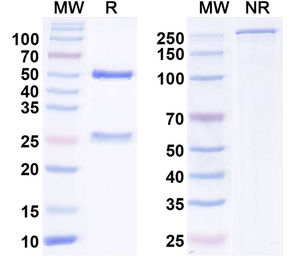 SDS-PAGE for Anti-Helicobacter pylori ureA/Urease subunit alpha Antibody (HpU-2)