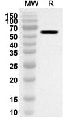 Western blot analysis was performed using anti-Corynephage omega DT/Diphtheria toxin polyclonal antibody at 1ug/mL on recombinant Corynephage omega DT/Diphtheria toxin (Catalog No. JN967022).