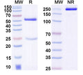 SDS-PAGE for Anti-Corynephage omega DT/Diphtheria toxin Antibody (DTD76)