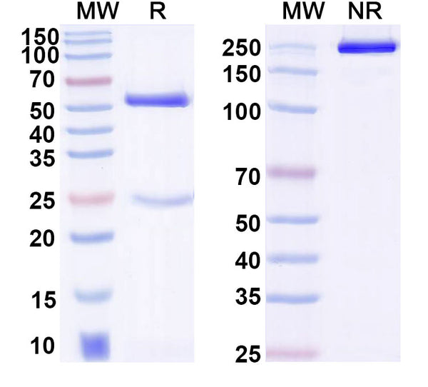 SDS-PAGE for Anti-Corynephage omega DT/Diphtheria toxin Antibody (DTD76)