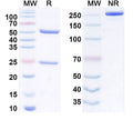Anti-Staphylococcus aureus LukGH Reference Antibody (Berlimatoxumab) – Figure 1 of 1
