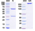 SDS-PAGE for Anti-Clostridium tetani tetX/Tetanus toxin Antibody (SAA0801)
