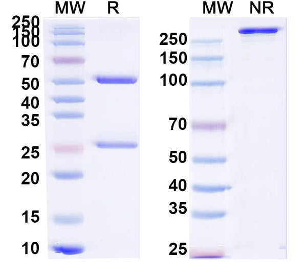 SDS-PAGE for Anti-Clostridium tetani tetX/Tetanus toxin Antibody (SAA0801)