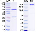 SDS-PAGE for Anti-Clostridium tetani tetX/Tetanus toxin Antibody (SAA0855)