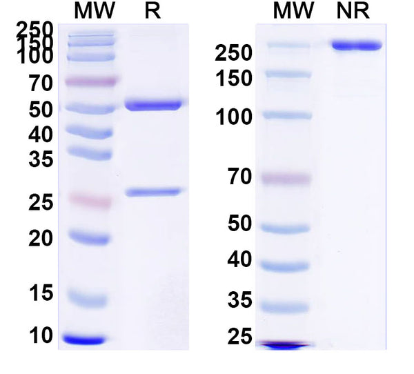 SDS-PAGE for Anti-Clostridium tetani tetX/Tetanus toxin Antibody (SAA0859)