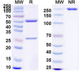 SDS-PAGE for Anti-Clostridium tetani tetX/Tetanus toxin Antibody (SAA0860)