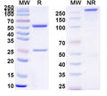 SDS-PAGE for Anti-Clostridium tetani tetX/Tetanus toxin Antibody (SAA0861)