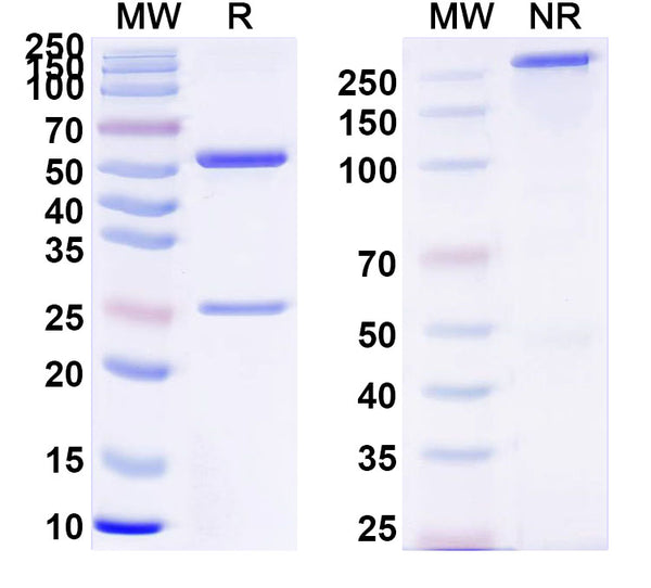 SDS-PAGE for Anti-Clostridium tetani tetX/Tetanus toxin Antibody (SAA0863)