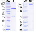 SDS-PAGE for Anti-Clostridium tetani tetX/Tetanus toxin Antibody (SAA0865)