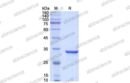SDS-PAGE for IdeS Protease (IgG Specific)