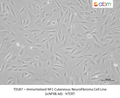 Immortalized NF1 Cutaneous Neurofibroma Cell Line (icNF98.4d) - hTERT – Figure 1 of 1