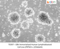 EBV Immortalized Human Lymphoblastoid Cell Line (PIP5K3 c.2256delA) | Applied Biological Materials (abm)